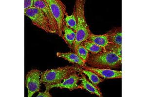 Immunocytochemistry (ICC) image for anti-Phospholipase D2 (PLD2) (AA 834-933) antibody (ABIN5881791) (Phospholipase D2 antibody  (AA 834-933))