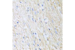 Immunohistochemistry of paraffin-embedded mouse heart using RCN2 antibody at dilution of 1:100 (x40 lens). (RCN2 antibody)