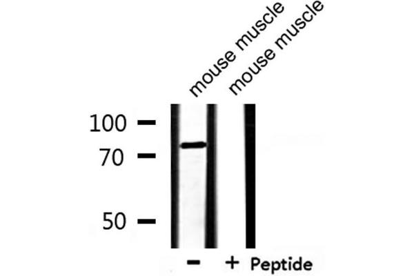 SLCO1B1 antibody