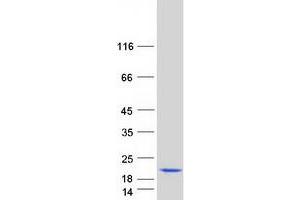Validation with Western Blot (PYCARD Protein (Transcript Variant 3) (Myc-DYKDDDDK Tag))