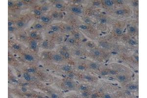 Detection of SHH in Human Liver Tissue using Polyclonal Antibody to Hedgehog Homolog, Sonic (SHH) (Sonic Hedgehog antibody  (AA 36-193))