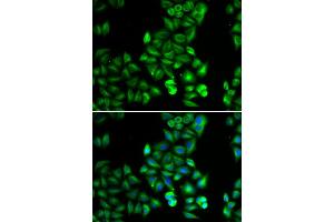 Immunofluorescence analysis of HeLa cell using DRD5 antibody.