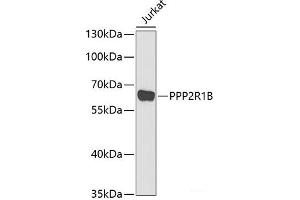 PPP2R1B antibody