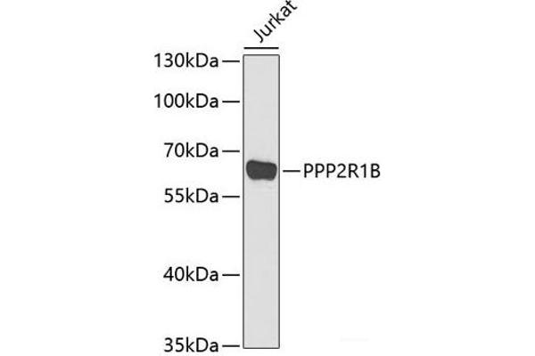 PPP2R1B antibody