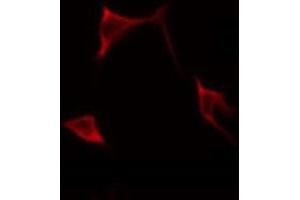 ABIN6268699 staining HeLa by IF/ICC. (BMP3 antibody  (Internal Region))