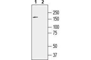 SLITRK2 antibody  (Extracellular, N-Term)