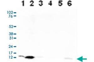 HIST1H4A antibody  (acLys5)
