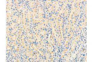 ABIN6263909 and ABIN6272972 at 1/100 staining Rat kidney tissue by IHC-P. (OSBP antibody  (Internal Region))