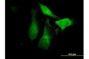 Immunofluorescence of purified MaxPab antibody to CFHR1 on HeLa cell.