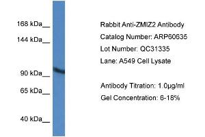 Western Blotting (WB) image for anti-Zinc Finger, MIZ-Type Containing 2 (ZMIZ2) (Middle Region) antibody (ABIN2788517) (ZMIZ2 antibody  (Middle Region))