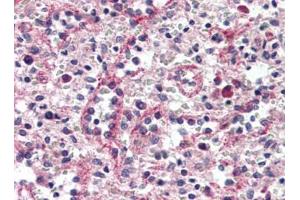 Human Spleen, Red Pulp (formalin-fixed, paraffin-embedded) stained with CTNND1at 1/15 followed by biotinylated goat anti-rabbit IgG secondary antibody, alkaline phosphatase-streptavidin and chromogen. (CTNND1 antibody  (C-Term))