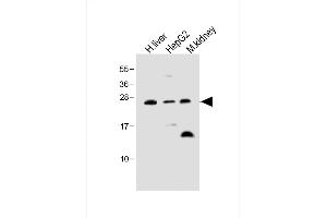 All lanes : Anti-Erythropoietin Antibody at 1:500 dilution Lane 1: Human liver lysate Lane 2: HepG2 whole cell lysate Lane 3: Mouse kidney lysate Lysates/proteins at 20 μg per lane. (EPO antibody)