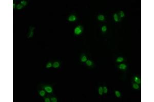 Immunofluorescence staining of PC3 cells with ABIN7127500 at 1:60, counter-stained with DAPI. (Recombinant FOXO3 antibody)