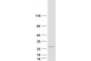 Validation with Western Blot (PCNP Protein (Myc-DYKDDDDK Tag))