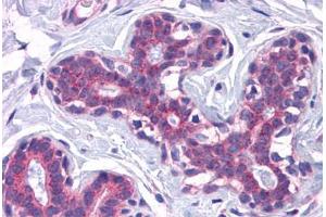 Human Breast: Formalin-Fixed, Paraffin-Embedded (FFPE) (SCAMP4 antibody  (C-Term))