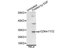 Western blot analysis of extracts of various cell lines, using Phospho-CDK4-T172 antibody (ABIN5995651). (CDK4 antibody  (pThr172))