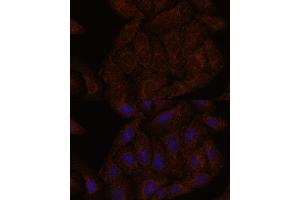 Immunofluorescence (IF) image for anti-Septin 8 (SEPT8) (AA 348-427) antibody (ABIN7265350)