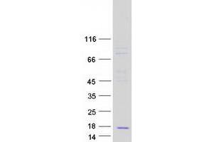 Western Blotting (WB) image for Chemokine (C-C Motif) Ligand 23 (CCL23) protein (Myc-DYKDDDDK Tag) (ABIN2726050)