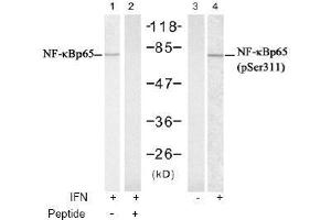 Image no. 2 for anti-Nuclear Factor-kB p65 (NFkBP65) (Ser311) antibody (ABIN197511) (NF-kB p65 antibody  (Ser311))