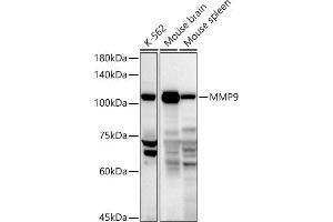 Western blot analysis of extracts of various cell lines, using MMP9 antibody (ABIN3022899, ABIN3022900, ABIN3022901, ABIN1513215 and ABIN6219286) at 1:1000 dilution. (MMP 9 antibody  (AA 538-707))