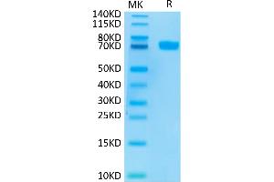 Mesothelin Protein (MSLN) (AA 296-580) (Fc Tag)