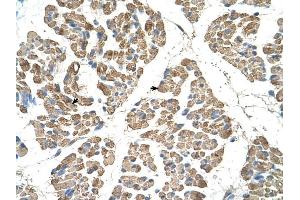 SLC22A7 antibody was used for immunohistochemistry at a concentration of 4-8 ug/ml to stain Skeletal muscle cells (arrows) in Human Muscle. (SLC22A7 antibody)