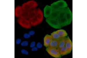 ABIN6262407 and ABIN6276441 staining Hela cells(30 min of UV treatment) by IF/ICC. (GRP94 antibody  (C-Term))