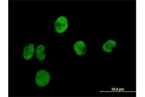 Immunofluorescence (IF) image for anti-Replication Protein A2, 32kDa (RPA2) (AA 1-270) antibody (ABIN519843)