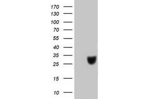 HEK293T cells were transfected with the pCMV6-ENTRY control (Left lane) or pCMV6-ENTRY C20orf43 (Right lane) cDNA for 48 hrs and lysed. (C20orf43 antibody)