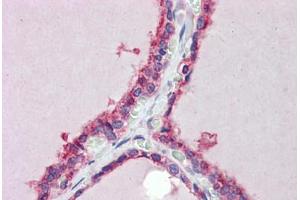 Human Thyroid (formalin-fixed, paraffin-embedded) stained with TRIM8 antibody ABIN462222 followed by biotinylated goat anti-rabbit IgG secondary antibody ABIN481713, alkaline phosphatase-streptavidin and chromogen. (TRIM8 antibody  (AA 36-85))
