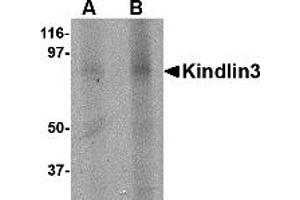 Western Blotting (WB) image for anti-Fermitin Family Member 3 (FERMT3) (C-Term) antibody (ABIN1030468) (FERMT3 antibody  (C-Term))