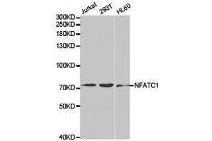 Western Blotting (WB) image for anti-Nuclear Factor of Activated T-Cells, Cytoplasmic, Calcineurin-Dependent 1 (NFATC1) antibody (ABIN1873889)
