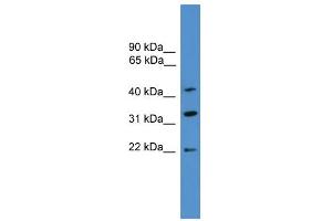 WB Suggested Anti-ARFIP1  Antibody Titration: 0. (ARFIP1 antibody  (C-Term))