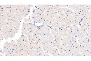 Detection of SSA1 in Mouse Cardiac Muscle Tissue using Polyclonal Antibody to Sjogren Syndrome Antigen A1 (SSA1) (TRIM21 antibody  (AA 272-470))