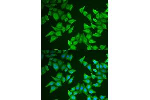 Immunofluorescence analysis of HeLa cells using ALAS2 antibody (ABIN5973907).