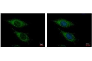 ICC/IF Image OGDH antibody [C2C3], C-term detects OGDH protein at Mitochondria by immunofluorescent analysis. (alpha KGDHC antibody  (C-Term))