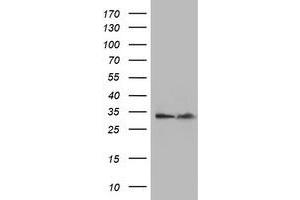 Western Blotting (WB) image for anti-Exosome Component 7 (EXOSC7) antibody (ABIN1498143)