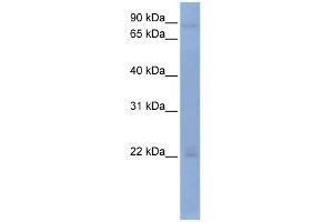 WB Suggested Anti-OAS2 Antibody Titration:  0. (OAS2 antibody  (Middle Region))