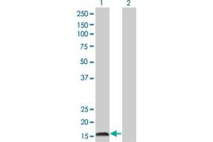 Western Blot analysis of IFNA2 expression in transfected 293T cell line by IFNA2 monoclonal antibody (M38), clone 2D10. (IFNA2 antibody  (AA 24-188))