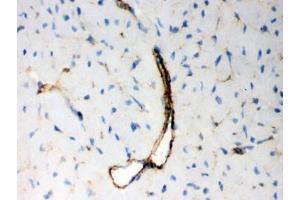 Immunohistochemistry (IHC) image for anti-BCL2-Antagonist/killer 1 (BAK1) (AA 22-211) antibody (ABIN4950296)