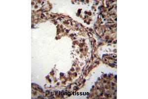 TUBA1C Antibody (C-term) immunohistochemistry analysis in formalin fixed and paraffin embedded human lung tissue followed by peroxidase conjugation of the secondary antibody and DAB staining. (TUBA1C antibody  (C-Term))