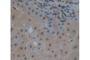 Used in DAB staining on fromalin fixed paraffin- embedded Kidney tissue (BIRC2 antibody  (AA 344-593))