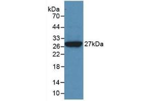 Detection of Recombinant CLU, Human using Monoclonal Antibody to Clusterin (CLU) (Clusterin antibody  (AA 228-449))