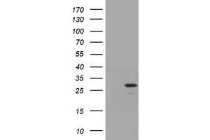 Image no. 1 for anti-Trafficking Protein Particle Complex 4 (TRAPPC4) antibody (ABIN1501266)