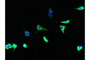 Immunofluorescent analysis of Hela cells using ABIN7153737 at dilution of 1:100 and Alexa Fluor 488-congugated AffiniPure Goat Anti-Rabbit IgG(H+L) (TSTA3 antibody  (AA 1-314))