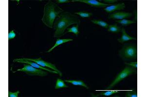 Immunofluorescence of purified MaxPab antibody to FXR2 on HeLa cell. (FXR2 antibody  (AA 1-673))