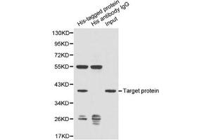 Image no. 1 for anti-His Tag antibody (ABIN2970882) (His Tag antibody)