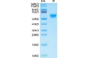 Mouse CLEC7A on Tris-Bis PAGE under reduced condition. (CLEC7A Protein (AA 71-244) (Fc Tag))