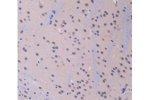 IHC-P analysis of brain tissue, with DAB staining. (IL12A antibody  (AA 23-215))