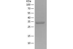 Western Blotting (WB) image for Galactosidase, alpha (GLA) (AA 322-409) protein (His-IF2DI Tag) (ABIN7123037) (GLA Protein (AA 322-409) (His-IF2DI Tag))